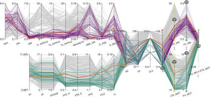 COMPO*SED: Composite Parallel Coordinates for Co-Dependent Multi-Attribute Choices